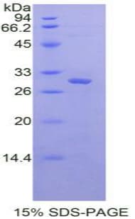Rat EIF2AK2 / PKR Protein (Recombinant His-T7)