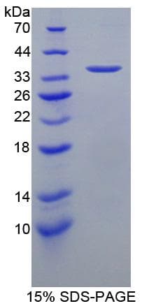 Mouse ICAM-1 / CD54 Protein (Recombinant His)