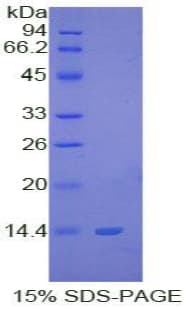 Human S100B / S100 Beta Protein (Recombinant His-T7)