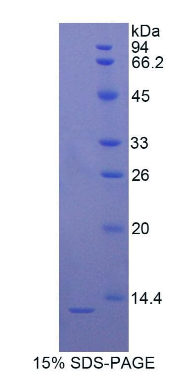 Rat S100B / S100 Beta Protein (Recombinant His)