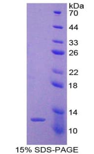 Human PEX2 / PAF-1 Protein (Recombinant His-T7)