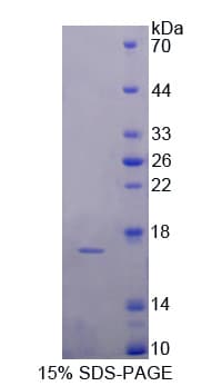 Rat Complement C7 Protein (Recombinant His-T7)
