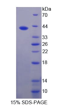 Bovine RETN / Resistin Protein (Recombinant His-GST-S)