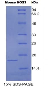 Mouse NOS3 / eNOS Protein (Recombinant His)