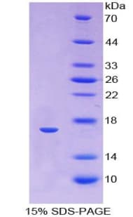 Human ANGPTL1 Protein (Recombinant His)