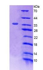 Rat TP53 / p53 Protein (Recombinant His, N-Terminal)