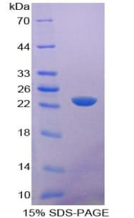 Mouse CD6 Protein (Recombinant His-T7)
