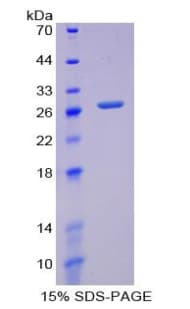 Human GCLM Protein (Recombinant His-T7)