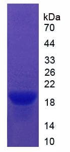Human VTN / Vitronectin Protein (Recombinant His)