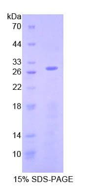 Human AIFM1 / AIF / PDCD8 Protein (Recombinant His-T7)