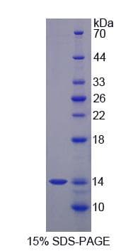 Rabbit S100A12 Protein (Recombinant His-S)