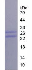 Human CD8A / CD8 Alpha Protein (Recombinant His)
