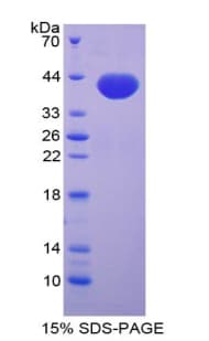 Human CCL14 Protein (Recombinant His-GST)