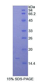 Human LYZ / Lysozyme Protein (Recombinant His)