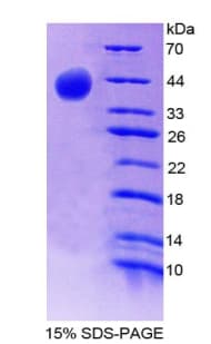 Rat Complement C8b Protein (Recombinant His-T7)