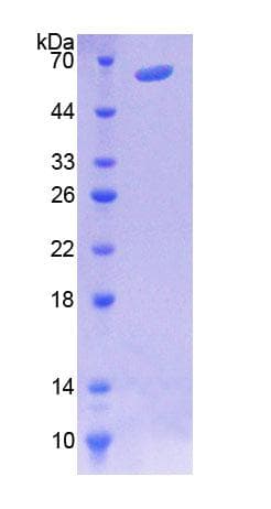 Human MAP4 Protein (Recombinant His-GST)