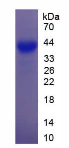Rat GAP43 Protein (Recombinant 6His, N-terminus)