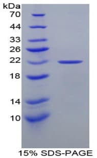 Rat GCKR Protein (Recombinant His)