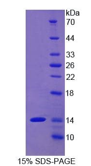Human THY1 / CD90 Protein (Recombinant His)