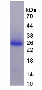 Human IFNAR1 / IFNAR Protein (Recombinant His)