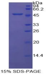 Bovine ENO1 / Alpha Enolase Protein (Recombinant His)