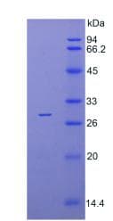 Human IRAK4 / IRAK-4 Protein (Recombinant His)