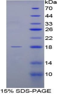 Rat FABP1 / L-FABP Protein (Recombinant His-T7)