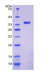 Human GDI1 Protein (Recombinant His-T7)
