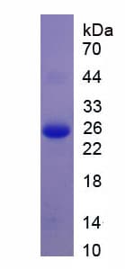 Human ANGPTL3 Protein (Recombinant His)