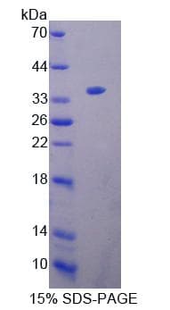 Mouse KEL / CD238 Protein (Recombinant His-T7)
