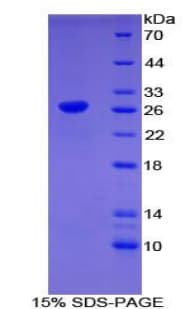 Mouse CLEC10A / CD301 Protein (Recombinant His-T7)