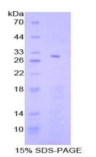Human STAT4 Protein (Recombinant His, N-Terminal)