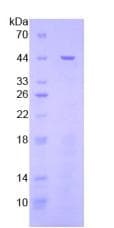 STAT3 Protein (Recombinant His-GST)