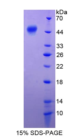 Human SERPINF1 / PEDF Protein (Recombinant His-T7)