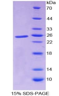 Human ADAMTS1 Protein (Recombinant His)