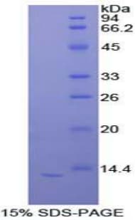 Rat IL-33 Protein (Recombinant His)