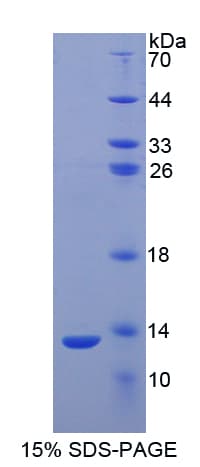 Human S100A2 Protein (Recombinant His)