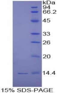Human CXCL11 Protein (Recombinant His-T7)