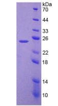 Mouse LAMB3 / Laminin Beta 3 Protein (Recombinant His-T7)
