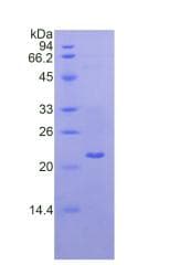 Mouse LAMC1 / Laminin Gamma 1 Protein (Recombinant His)