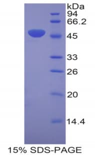 Mouse LAMC2 / Laminin Gamma 2 Protein (Recombinant His-GST)