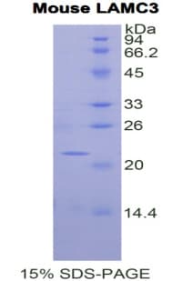 Mouse LAMC3 / Laminin Gamma 3 Protein (Recombinant His)