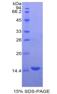 Human GDF3 Protein (Recombinant His)