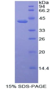 Human ACVR2 / ACVR2A Protein (Recombinant His-GST)