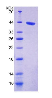 Human PPP1CA / PP1-Alpha Protein (Recombinant His-T7)
