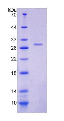 Rat DOK1 Protein (Recombinant His-T7)
