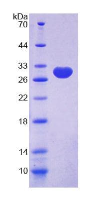 Human C/EBP Delta / CEBPD Protein (Recombinant His-T7)