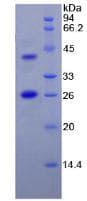 Human FAP Alpha Protein (Recombinant His, N-Terminal)