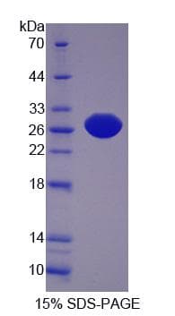 Bovine XDH / Xanthine Oxidase Protein (Recombinant His-S)