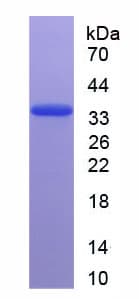 Rat IGFBP5 Protein (Recombinant His)